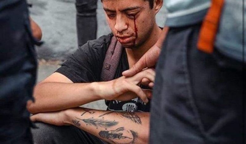 Policía de Chile está disparando a los ojos de los manifestantes para dejarlos ciegos. 