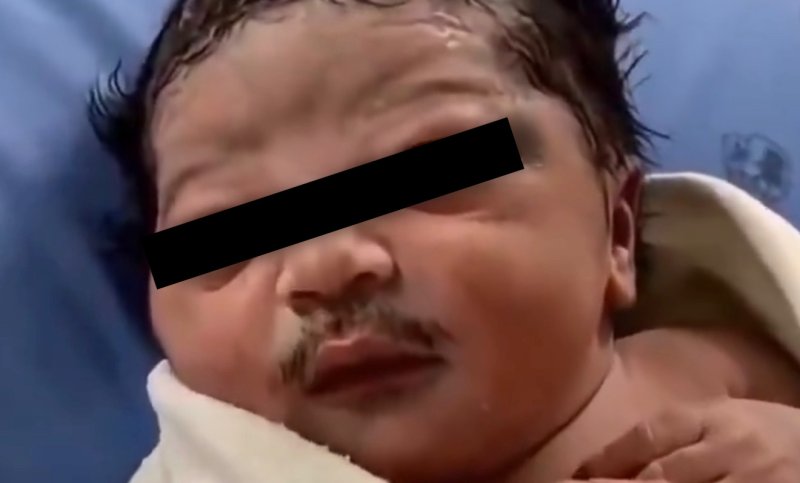 ¡Nació con bigote! Bebé recién nacido sorprende a las redes sociales por su peculiar apariencia