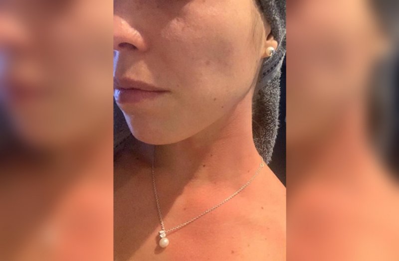 En Zapopan agreden con cloro a doctora que sacó a pasear a su perro 