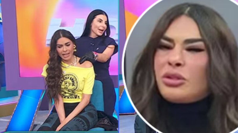 “No aprende”: Critican a Galilea por someterse a otro tratamiento estético,