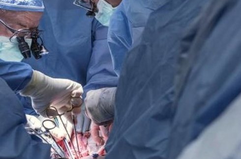 Transplantan un riñón a la persona equivocada solo porque se llamaba igual que el paciente 