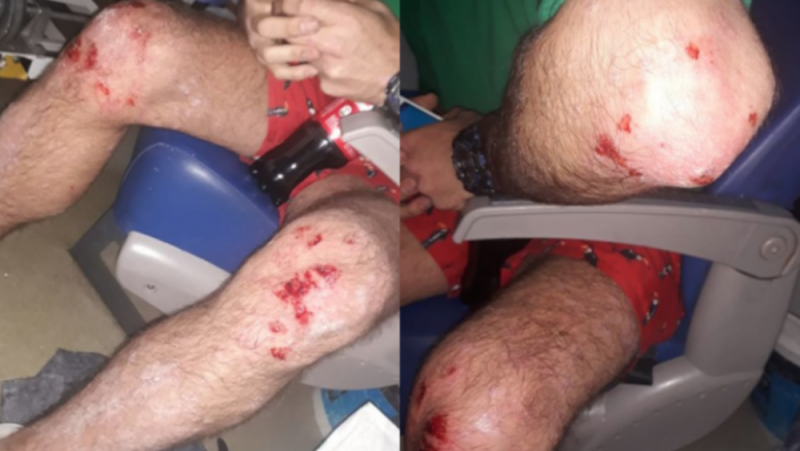 Sujeto homofóbico ataca brutalmente con un látigo a pareja de gays