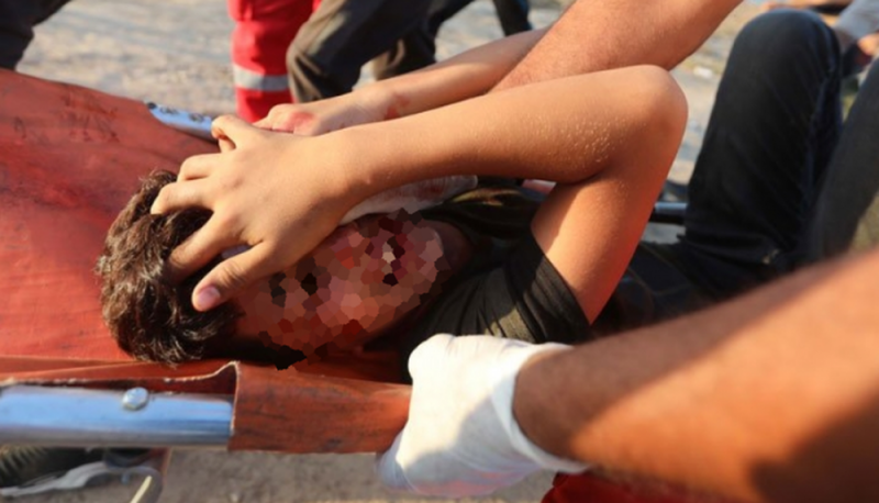 Estudiante de Chiapas que fue golpeado por sus compañeros podría perder un ojo