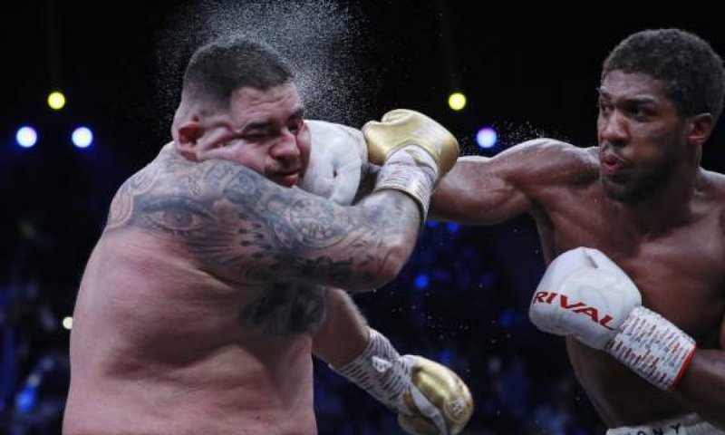 #EnExclusiva Andy Ruiz muestra detalladamente las heridas que le hizo Anthony Joshua (VIDEO)