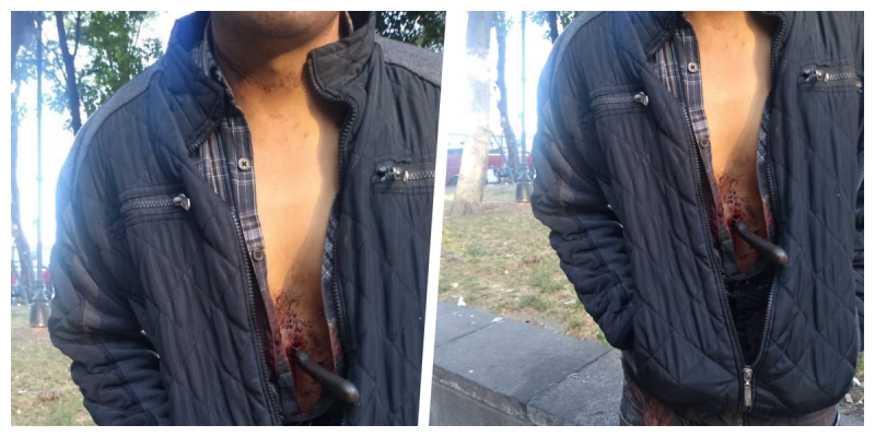 Hombre pasea con un cuchillo enterrado en el estómago en calles de la CDMX