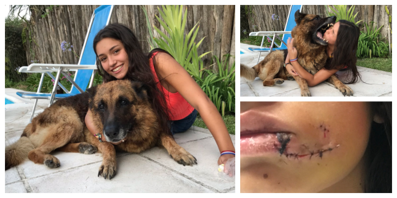 Sesión de selfies con su perra sale mal y casi le arranca la cara