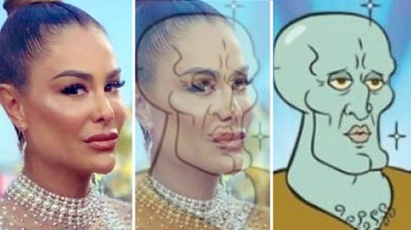 Estos son los mejores memes de Ninel Conde tras su nueva operación