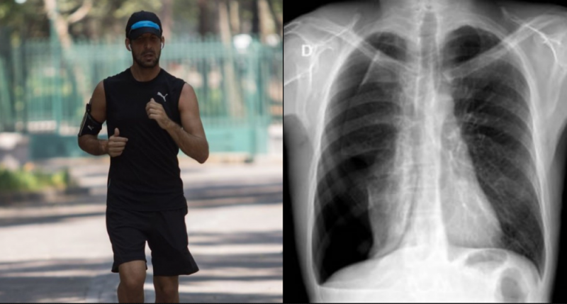 Joven corre 3 km con CUBREBOCAS y sufre COLAPSO PULMONAR