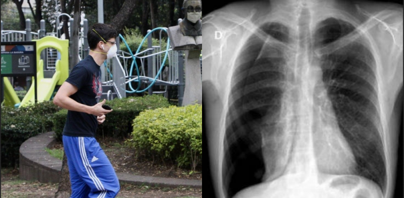 Joven corre 3 km con CUBREBOCAS y sufre COLAPSO PULMONAR