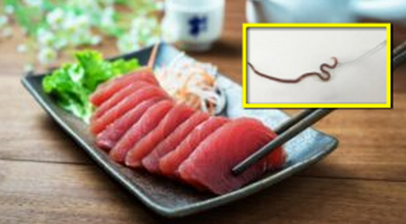 MUJER come sashimi y le crece GUSANO en la GARGANTA 