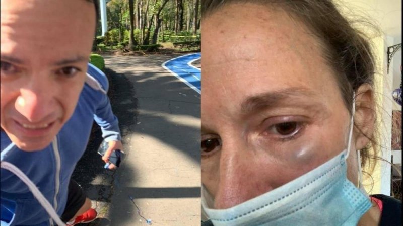 #ÚltimaHora IDENTIFICAN a golpeador de mujeres del Parque Hundido; se llama Rolando