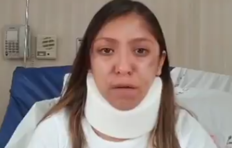 Joven cuenta BRUTAL ataque de su novio con el que vivió 3 meses 