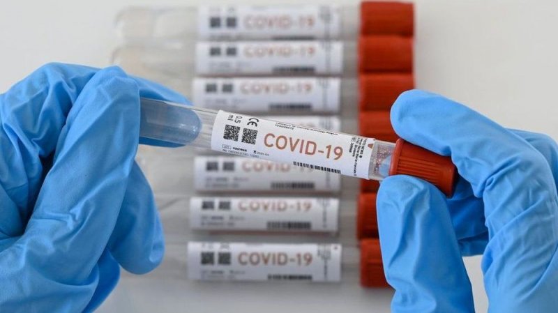 MÉXICO es de los países que MENOS pruebas de Covid-19 aplica