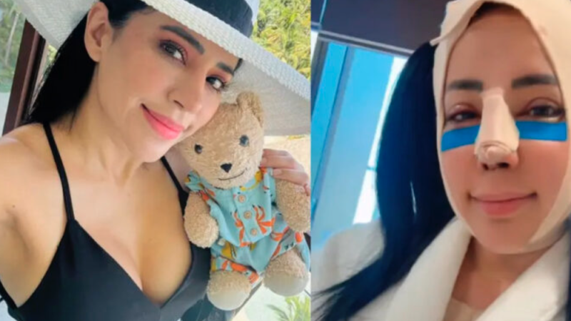 Sandra Cuevas reaparece tras cirugía plástica y sorprende a sus fans con su nuevo rostro