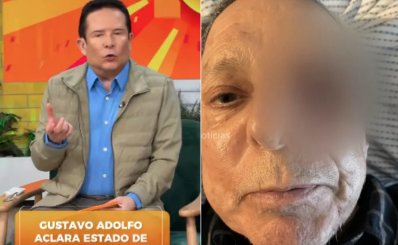 Ofrece Gustavo Adolfo Infante disculpa a César Bono por difundir que había perdido el ojo
