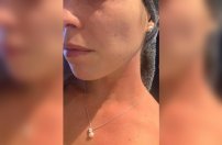 En Zapopan agreden con cloro a doctora que sacó a pasear a su perro 