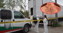 Infectados de sarampión, viruela y varicela centroamericanos detenidos en Mexico.