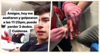 Lo asaltan, cortan sus dedos y lo golpean con un bat afuera del Metro, denuncia estudiante