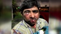 Mexicano es golpeado brutalmente en Miami mientras paseaba a su perro (VIDEO)